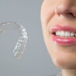 Invisalign: The Benefits are Clear Kennesaw, GA
